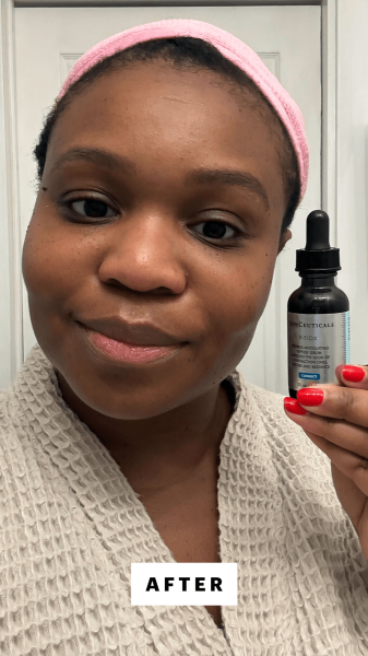 Cruel after applying the SkinCeuticals PTiox